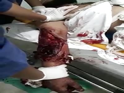 man exchanged shot with the police and was shot in the arm in Minas Gerais Brazil