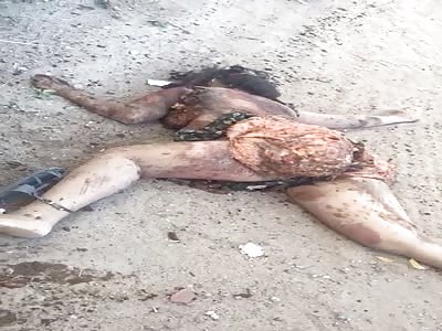 HORRIFIC Accident Naked fat Woman