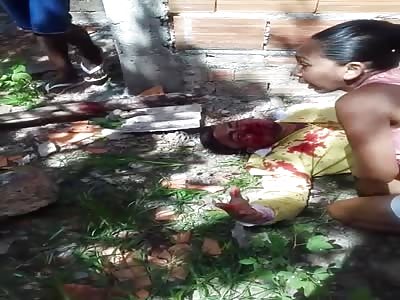 Agonizing after shot on the face