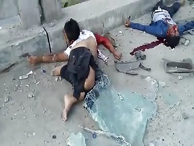 HORRIFIC Accident man gets all twisted