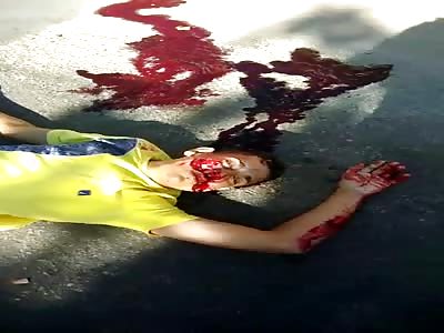 thief agonizing after get shot by police 