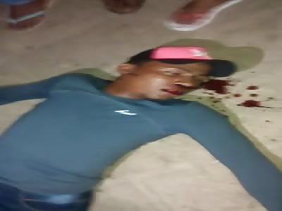 Agonizing after shot on the face