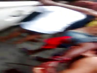 Man get shot on the leg in war rio