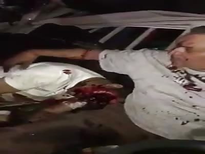 Horrific accident with pic up truck