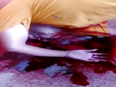 Man shot in the face and chest agonizes to death