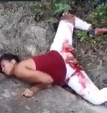 Woman's Vagina Ripped Off in Accident Between Motorcycle and Car 