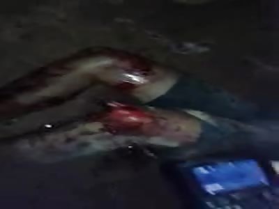 thief had his leg broken in an aggression