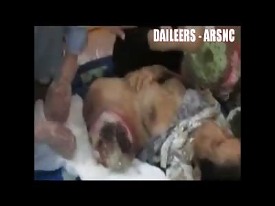 woman with scary cancer