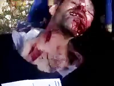 Man Killed In war battle