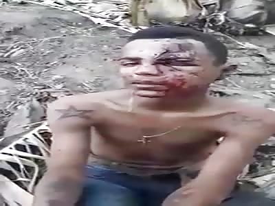 face destroyed by a shot