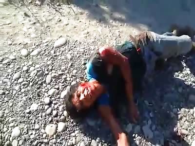 man was shot and has broken arm in agony of pain