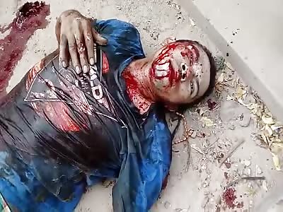 Injuried after get several shot