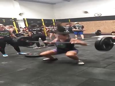 Accident with leg girl 