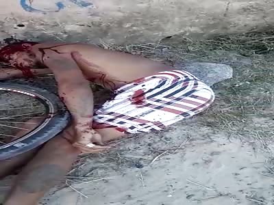 agonizing after get shot