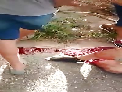 Accident  with bike leg destroyed 