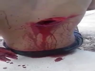 thief stabbed after robbery 