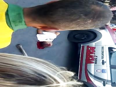 agonizing after shot