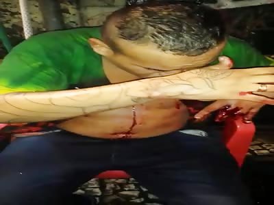 man injuried after get shot 