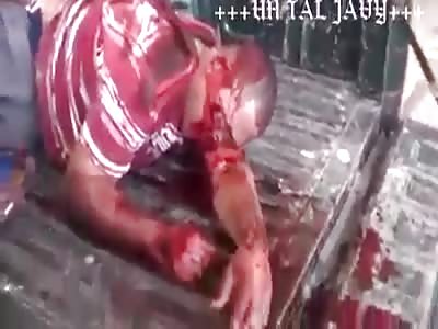 Agonizing after get shot