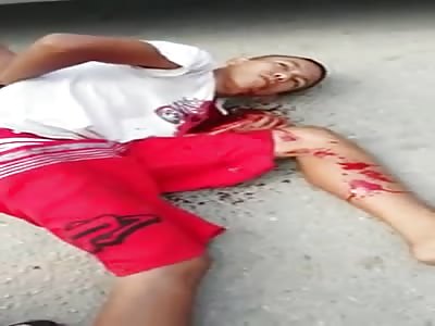 thief agonizing after get shot