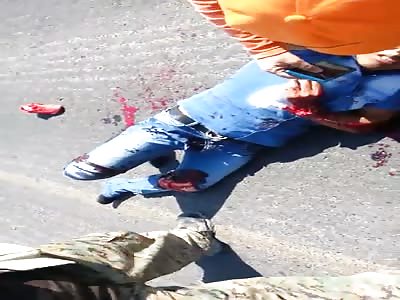  Fatal motorcycle accident leaves injured young