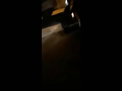 Accident horror girl shredded legs