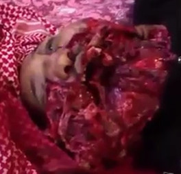 Dead Man with Nasty Blasted Mouth