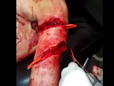 Ghastly Ripped Cut In Arm