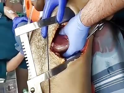  Scenes from an emergency thoracotomy