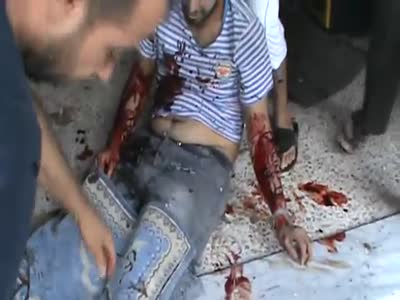  Car Driver Wounded After Shelling In Aleppo City