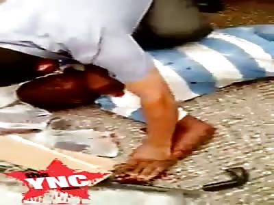 a Microbus crashes into a pole the passenger is dying  