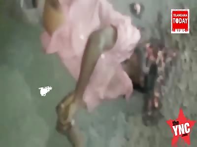 a mans head cracked open after a accident when he was hit by a lorry At Tardbun Road Under Bahadurpura