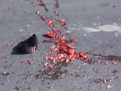 brain accident in Nepal