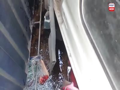 woman lost her foot in a accident in Cambodia @0:20 