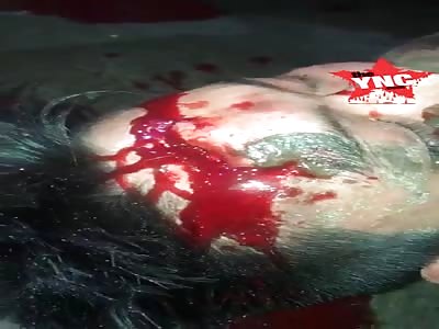  a youth  in much pain after a accident in Cambodia 