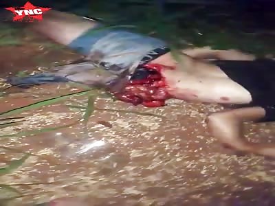 Fatal Accident a mans insides are exposed   in Colonia Minga PorÃ¡, Alto Parana, Paraguay