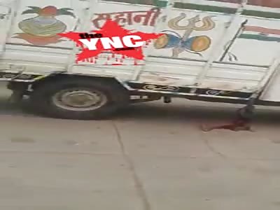 man lost his arm at  Basant , Rajasthan 306708, India