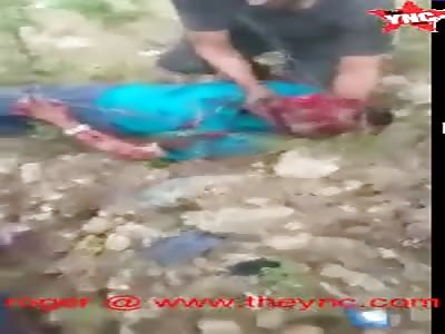 man in pain after a accident in Colombia 