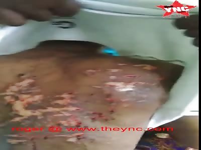  son-in-law tortured his  mother in Penang, Perda City