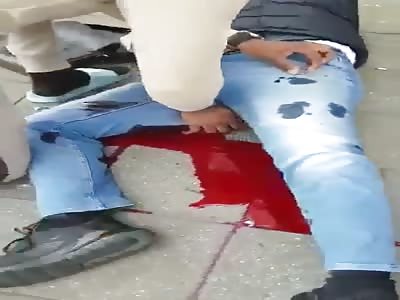 Femoral Artery Bleeding