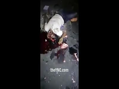 Man Motorcyclist was Crushed by Truck