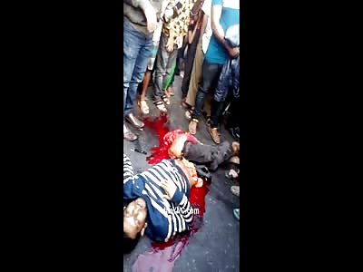 HORRIBLE ACCIDENT: MAN CUT IN HALF STILL ALIVE