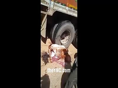 The Man Was Split in Two by a Truck