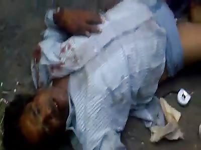 Railway Accident : Man in Total Agony With his Legs Cut by a Train