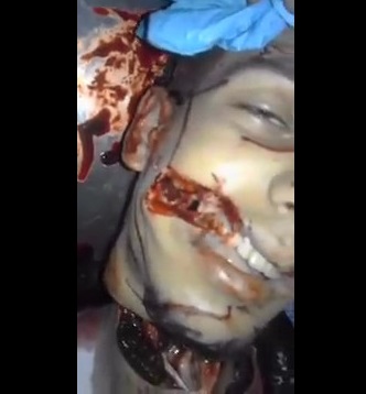 *aftermath* Young Man Hacked to Death