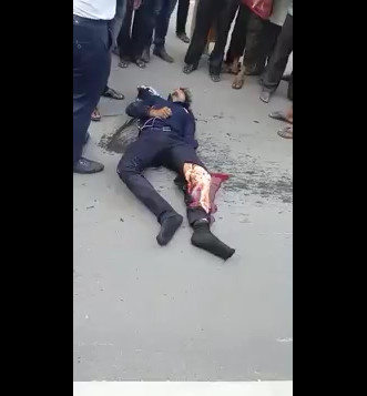 Leg Skinned in Accident