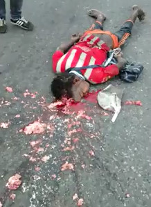 Man With Destroyed Skull after a Deadly Meeting with the Street