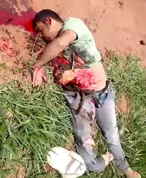 Dead Man Skinned to the Guts and his Leg 