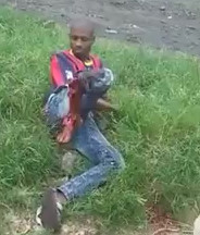 UGH...Man with Nasty Leg Break