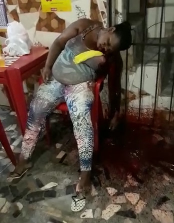 Drunk Woman was Brutally Gunned Inside a Bar